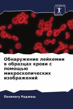 Obnaruzhenie lejkemii w obrazcah krowi s pomosch'ü mikroskopicheskih izobrazhenij - Radzhesh, Polepogu