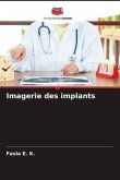 Imagerie des implants