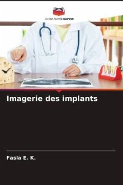 Imagerie des implants - E. K., Fasla