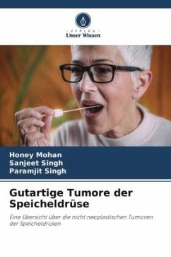 Gutartige Tumore der Speicheldrüse - Mohan, Honey;Singh, Sanjeet;Singh, Paramjit