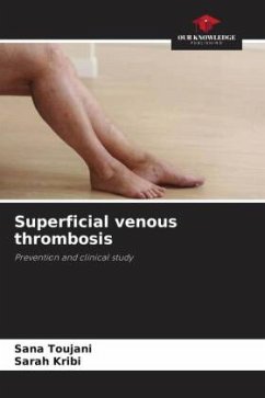 Superficial venous thrombosis - Toujani, Sana;Kribi, Sarah