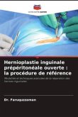 Hernioplastie inguinale prépéritonéale ouverte : la procédure de référence