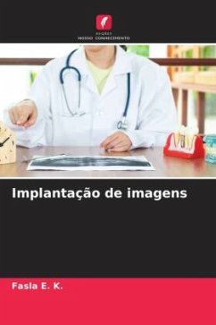 Implantação de imagens - E. K., Fasla