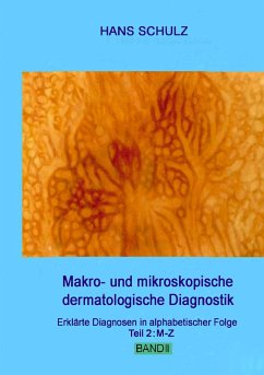 Makro- und mikroskopische dermatologische Diagnostik Band 2 - Schulz, Hans