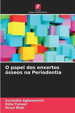 O papel dos enxertos ósseos na Periodontia - Aghanashini, Suchetha;Tanwar, Esha;Bhat, Divya