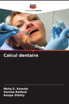Calcul dentaire - Kawale, Neha.S.;Rathod, Varsha;Shetty, Anupa