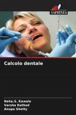 Calcolo dentale