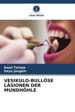 VESIKULO-BULLÖSE LÄSIONEN DER MUNDHÖHLE - Talreja, Kajol;Jangam, Daya