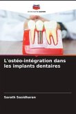 L'ostéo-intégration dans les implants dentaires