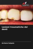 Lesioni traumatiche dei denti