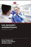 Les poussées endodontiques