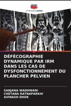 DÉFÉCOGRAPHIE DYNAMIQUE PAR IRM DANS LES CAS DE DYSFONCTIONNEMENT DU PLANCHER PELVIEN - Wadhwani, Sanjana;Ratnaparkhi, Chetana;Dhok, Avinash