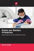 Posts em Dentes Primários