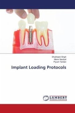 Implant Loading Protocols