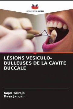LÉSIONS VÉSICULO-BULLEUSES DE LA CAVITÉ BUCCALE - Talreja, Kajol;Jangam, Daya