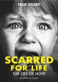 SCARRED FOR LIFE (eBook, ePUB)