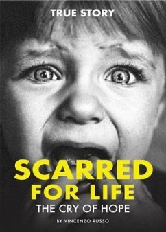 SCARRED FOR LIFE (eBook, ePUB) - Russo, Vincenzo