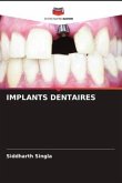 IMPLANTS DENTAIRES