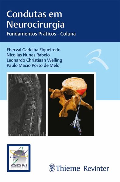 Condutas em Neurocirurgia (eBook, ePUB) Condutas em Neurocirurgia (eBook, ePUB)