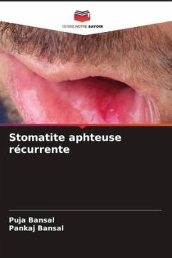 Stomatite aphteuse récurrente - Bansal, Puja;Bansal, Pankaj