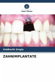 ZAHNIMPLANTATE