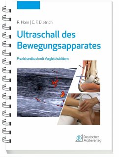 Ultraschall des Bewegungsapparates - Horn, Rudolf;Dietrich, Christoph F.