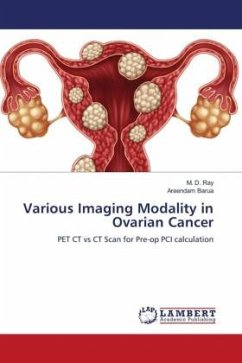 Various Imaging Modality in Ovarian Cancer