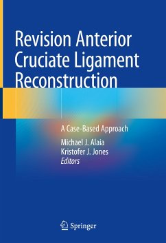 Revision Anterior Cruciate Ligament Reconstruction (eBook, PDF)