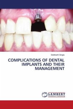 COMPLICATIONS OF DENTAL IMPLANTS AND THEIR MANAGEMENT - Singla, Siddharth