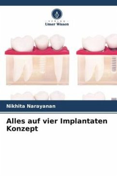 Alles auf vier Implantaten Konzept - Narayanan, Nikhita