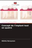 Concept de l'implant tout en quatre