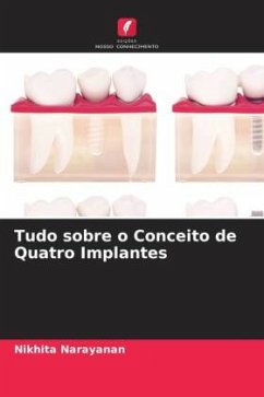 Tudo sobre o Conceito de Quatro Implantes - Narayanan, Nikhita