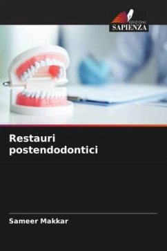 Cover Restauri postendodontici