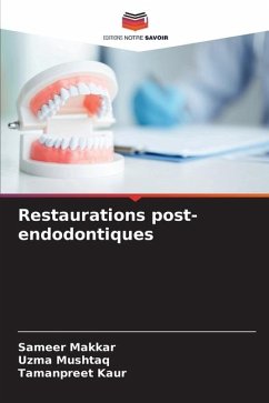 Restaurations post-endodontiques - Makkar, Sameer;Mushtaq, Uzma;Kaur, Tamanpreet