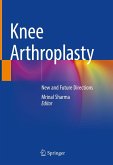 Knee Arthroplasty (eBook, PDF)