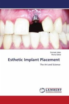 Esthetic Implant Placement - Jalan, Sumeet;Sahai, Richa