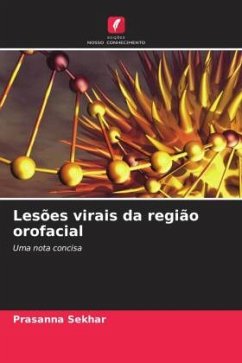 Lesões virais da região orofacial - Sekhar, Prasanna