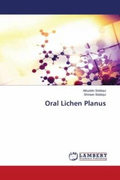 Oral Lichen Planus - Siddiqui, Attiuddin;Siddiqui, Shireen