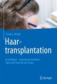 Haartransplantation (eBook, PDF)