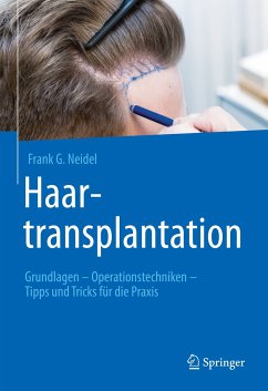 Haartransplantation (eBook, PDF) - Neidel, Frank G.