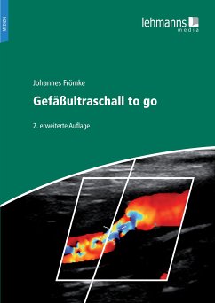 Gefäßultraschall to go (eBook, PDF) - Frömke, Johnnes