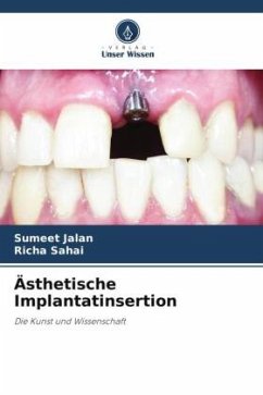 Ästhetische Implantatinsertion - Jalan, Sumeet;Sahai, Richa