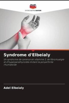 Syndrome d'Elbeialy - Elbeialy, Adel