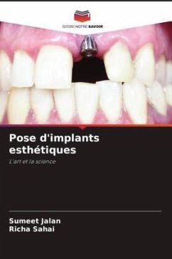 Pose d'implants esthétiques - Jalan, Sumeet;Sahai, Richa