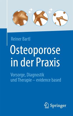 Osteoporose in der Praxis (eBook, PDF) - Bartl, Reiner