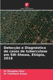 Detecção e Diagnóstico de casos de tuberculose em SW-Shewa, Etiópia, 2016