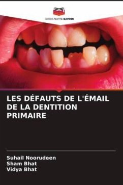 LES DÉFAUTS DE L'ÉMAIL DE LA DENTITION PRIMAIRE - Noorudeen, Suhail;Bhat, Sham;Bhat, Vidya