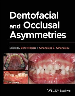 Cover Dentofacial and Occlusal Asymmetries