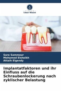 Implantatfaktoren und ihr Einfluss auf die Schraubenlockerung nach zyklischer Belastung - Sammour, Sara;Elsheikh, Mohamed;Elgendy, Attaih