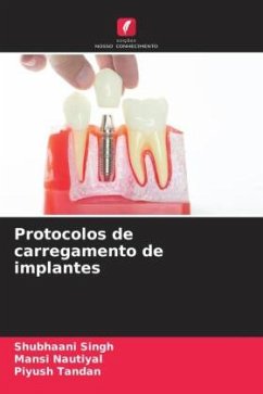 Protocolos de carregamento de implantes - Singh, Shubhaani;Nautiyal, Mansi;Tandan, Piyush